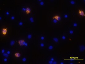 CXCL10/IP-10 antibody in Human PBMCs by Immunocytochemistry (ICC).