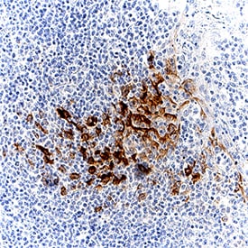 CXCL10/IP-10/CRG-2 antibody in Human Tonsil by Immunohistochemistry (IHC-P).
