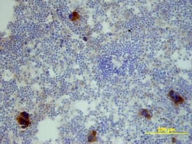 CXCL2/GRO beta /MIP-2/CINC-3 antibody in Mouse Spleen by Immunohistochemistry (IHC-Fr).