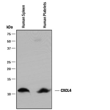 Detection of Human CXCL4/PF4 antibody by Western Blot.