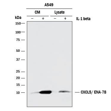 Detection of Human CXCL5/ENA-78 antibody by Western Blot.