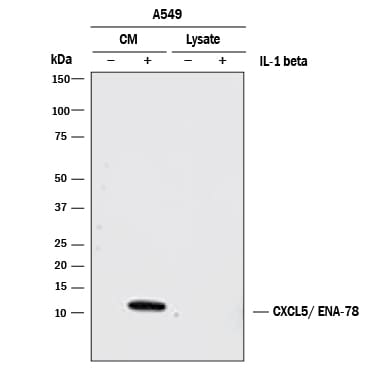 Detection of Human CXCL5/ENA-78 antibody by Western Blot.