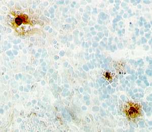 IL-8/CXCL8 antibody in Human Tonsil by Immunohistochemistry (IHC-P).
