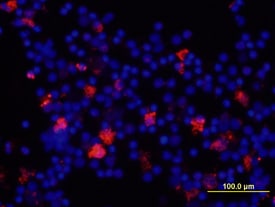 IL-8/CXCL8 antibody in Human PBMCs by Immunocytochemistry (ICC).