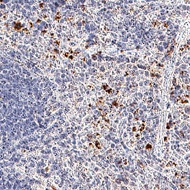 CXCR2/IL-8 RB antibody in Mouse Spleen by Immunohistochemistry (IHC-Fr).