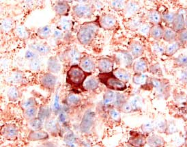 CXCR2/IL‑8 RB antibody in Human Lymph Node by Immunohistochemistry (IHC-P).