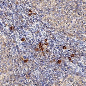 CXCR3 antibody in Human Tonsil by Immunohistochemistry (IHC-P).
