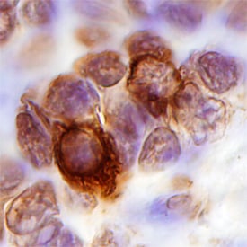 CXCR3 antibody in Human Tonsil by Immunohistochemistry (IHC-P).