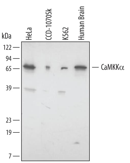 Detection of Human/Rat CaMKKa antibody by Western Blot.