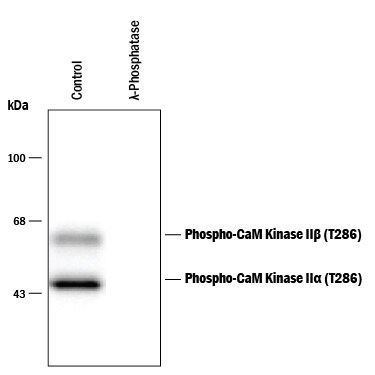 Detection of Phospho-CaM Kinase II (T286) antibody by Western Blot.