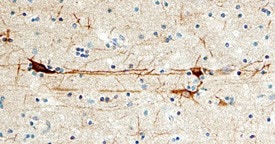 CaM Kinase IId antibody in Human Brain by Immunohistochemistry (IHC-P).
