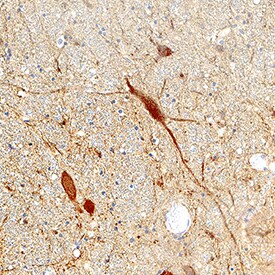 CaM Kinase II ? antibody in Human Brain by Immunohistochemistry (IHC-P).