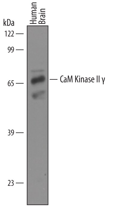 Detection of Human CaM Kinase II gamma antibody by Western Blot.