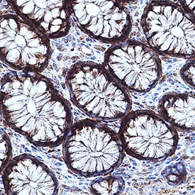 CaM Kinase II antibody in Human Intestine by Immunohistochemistry (IHC-P).