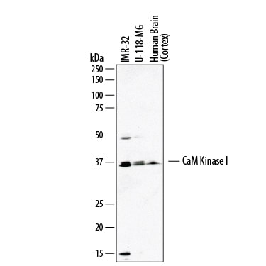 Detection of Human CaM Kinase I antibody by Western Blot.