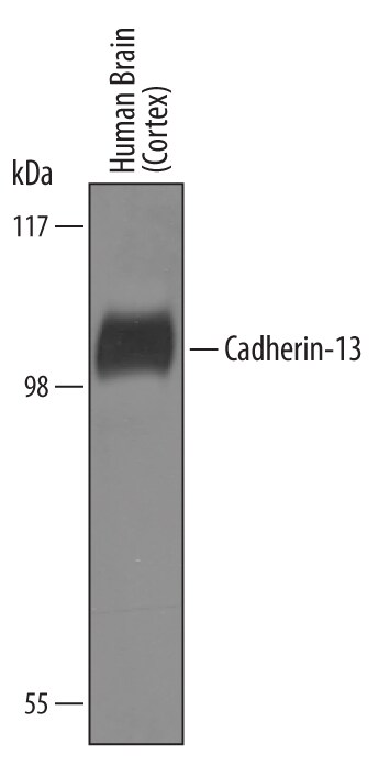 Detection of Human Cadherin-13 antibody by Western Blot.