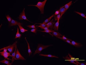 Cadherin-6/KCAD antibody in MG-63 Human Cell Line by Immunocytochemistry (ICC).
