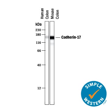 Detection of Human and Mouse Cadherin-17 antibody by Simple WesternTM.