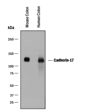 Detection of Human and Mouse Cadherin‑17 antibody by Western Blot.