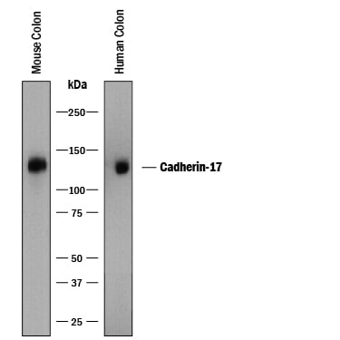 Detection of Human and Mouse Cadherin‑17 antibody by Western Blot.