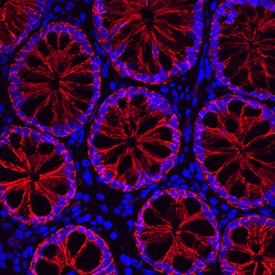 Cadherin-17 antibody in Human Ascending Colon by Immunohistochemistry (IHC-P).