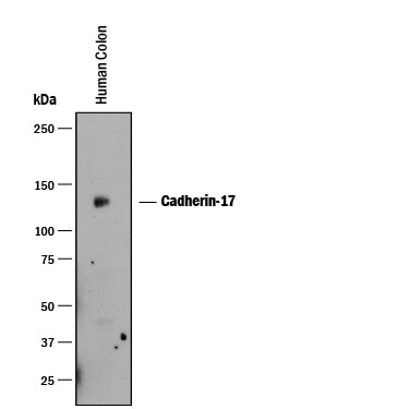 Detection of Human Cadherin‑17 antibody by Western Blot.