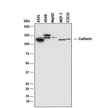Detection of Human and Mouse Cadherin antibody by Western Blot.