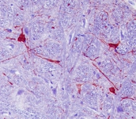 Calbindin D antibody in Rat Brainstem by Immunohistochemistry (IHC-P).