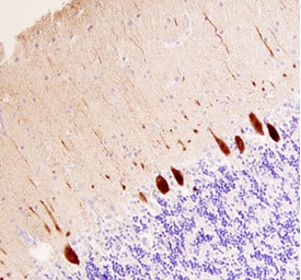 Calbindin D antibody in Human Brain by Immunohistochemistry (IHC-P).