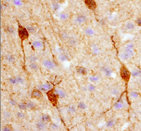 Calbindin D antibody in Rat Brain by Immunohistochemistry (IHC-Fr).
