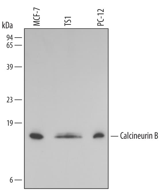 Detection of Human/Mouse/Rat Calcineurin B antibody by Western Blot.