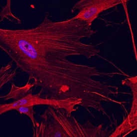 Caldesmon/CALD1 antibody in WI-38 Human Cell Line by Immunocytochemistry (ICC).