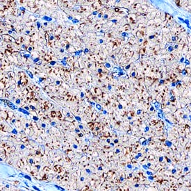 Calponin 1 antibody in Human Small Intestine by Immunohistochemistry (IHC-P).