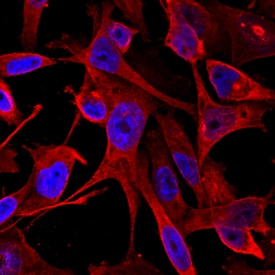 Calponin 1 antibody in MDA-MD-231 Human Cell Line by Immunocytochemistry (ICC).