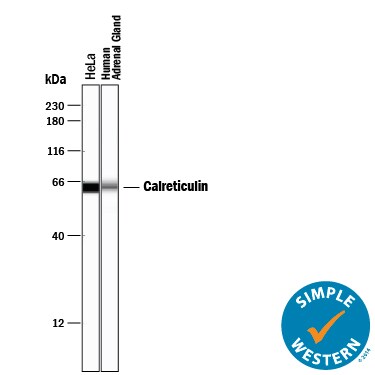 Detection of Human Calreticulin antibody by Simple WesternTM.