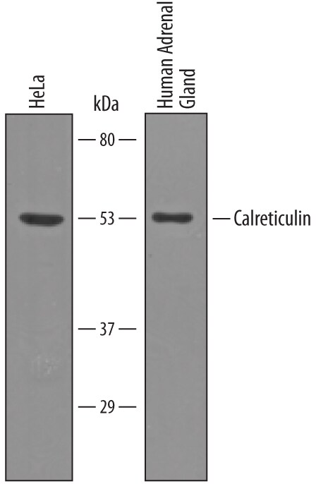 Detection of Human Calreticulin antibody by Western Blot.