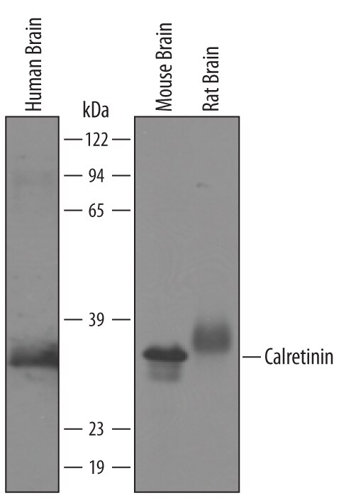 Detection of Human/Mouse/Rat Calretinin antibody by Western Blot.
