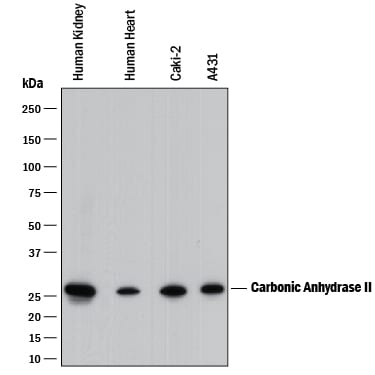 Detection of Human Carbonic Anhydrase II/CA2 antibody by Western Blot.