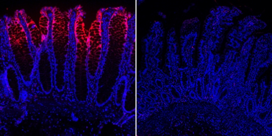 Carbonic Anhydrase II/CA2 antibody in Human Descending Colon and Ileum by Immunohistochemistry (IHC-P).