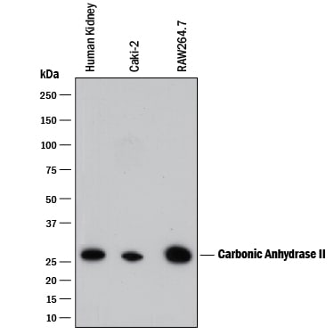 Detection of Human and Mouse Carbonic Anhydrase II/CA2 antibody by Western Blot.