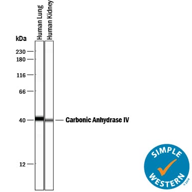 Detection of Human Carbonic Anhydrase IV/CA4 antibody by Simple WesternTM.