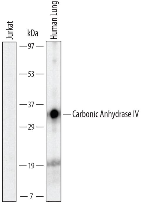 Detection of Human Carbonic Anhydrase IV/CA4 antibody by Western Blot.