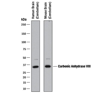 Detection of Human and Mouse Carbonic Anhydrase VIII/CA8 antibody by Western Blot.