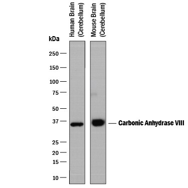 Detection of Human and Mouse Carbonic Anhydrase VIII/CA8 antibody by Western Blot.