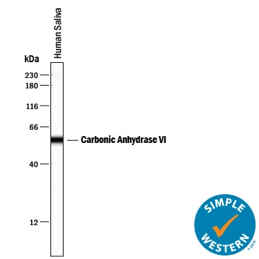 Detection of Human Carbonic Anhydrase VI antibody by Simple WesternTM.