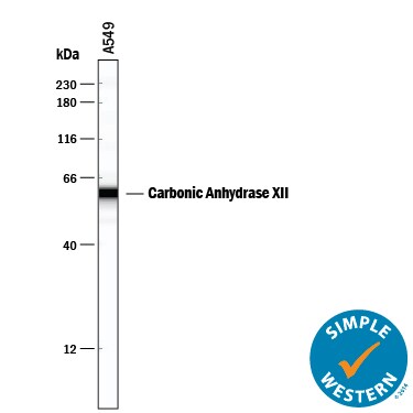 Detection of Human Carbonic Anhydrase XII/CA12 antibody by Simple WesternTM.