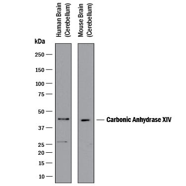 Detection of Human and Mouse Carbonic Anhydrase XIV/CA14 antibody by Western Blot.