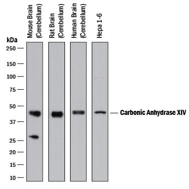 Detection of Human, Mouse, and Rat Carbonic Anhydrase XIV/CA14 antibody by Western Blot.