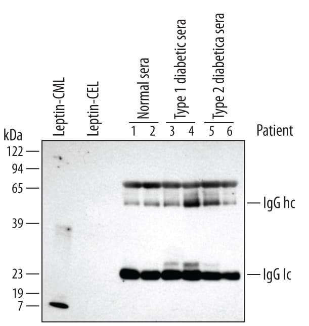 Detection of CML-adducted Protein antibody by Western Blot.