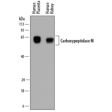 Detection of Human Carboxypeptidase M antibody by Western Blot.